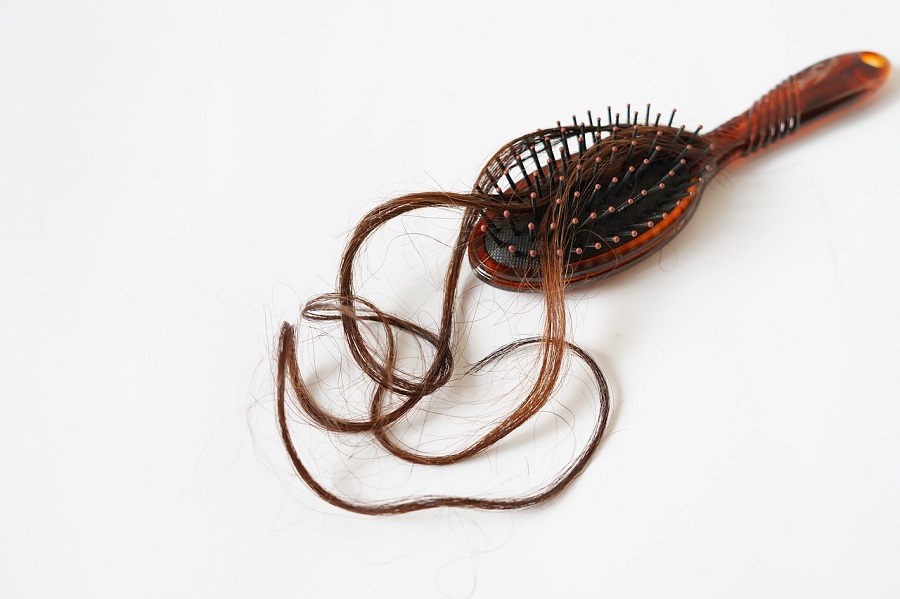 Quels sont les signes et les symptômes de la perte de cheveux?